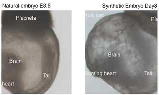 Scientists develop world's first 'synthetic embryos', bypassing need for sperm, eggs and fertilisation