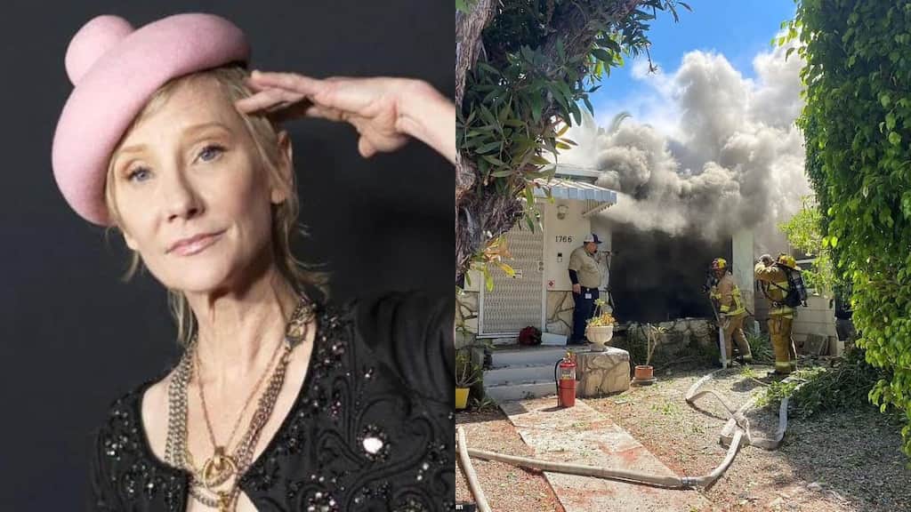 Anne Heche 'stable' in intensive care after sustaining several burns in car crash