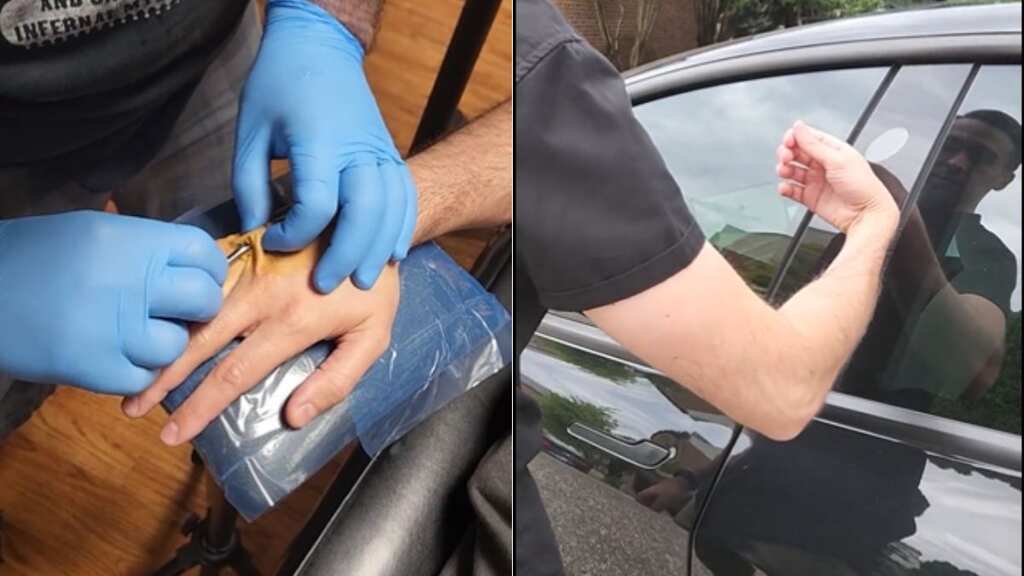Video: To avoid using car keys, Tesla owner inserts chip inside skin to unlock car 
