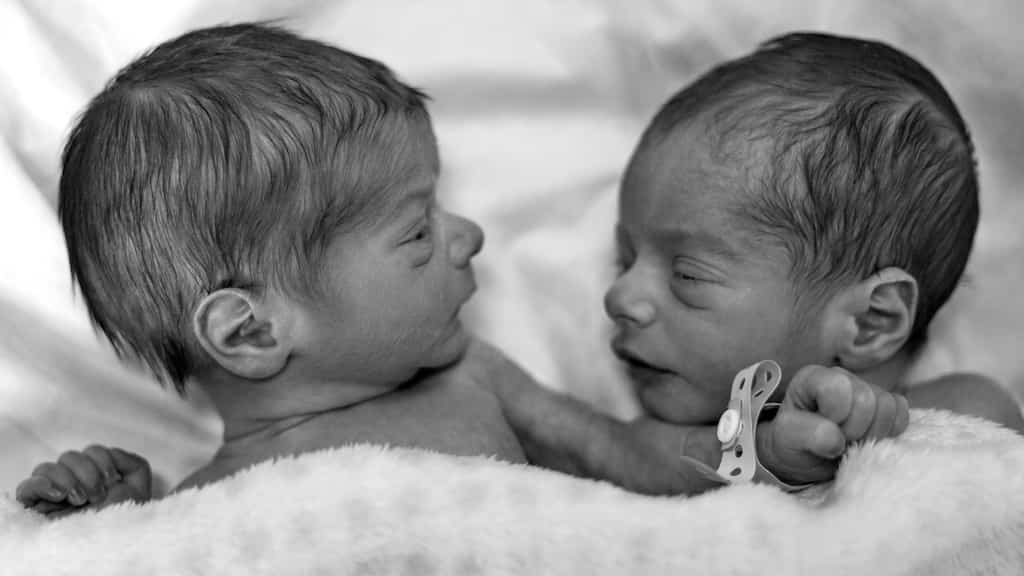 'One in a million': 19-year-old woman gives birth to twins with different biological dads