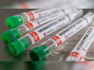 China's 'foreigner' advisory against monkeypox, recorded first case in Chongqing