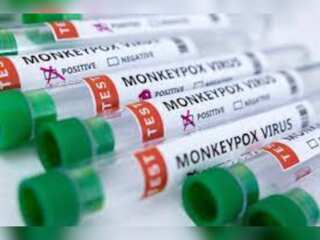 WION Fineprint | Chinese official warns against touching foreigners after monkeypox case