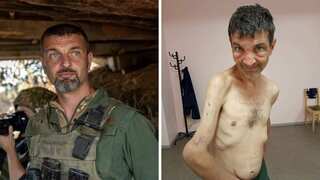 Ukraine releases shocking ‘before and after’ images of soldier freed from Russian captivity