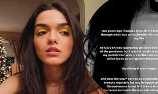 Scariest week of my life: Rachel Zegler, 21, reveals she had a breast cancer scare at age of 19