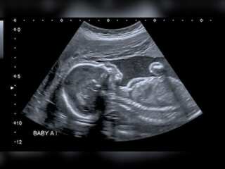 WION Climate Tracker | Research: Pollutants pose risk to baby boy's future sperm count