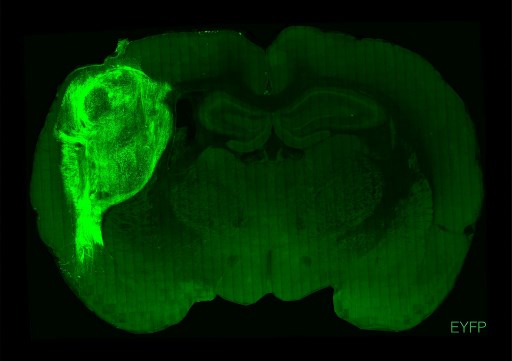Scientists have successfully implanted and integrated human brain cells into newborn rats