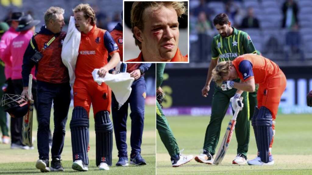 That's nasty! Haris Rauf hits Bas de Leede's face with a bouncer; player suffers concussion - Video