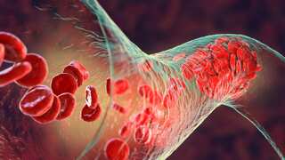 Lab-grown red blood cells transfused into humans in first-of-its-kind study