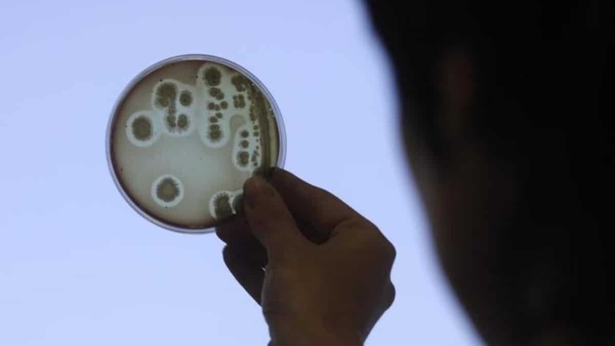 Bacterial infections killed nearly eight million people, second-leading cause of death in 2019: Study Bacterial infections killed nearly eight million people, second-leading cause of death in 2019: Study
