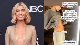 Hailey Bieber denies pregnancy rumours, says she has an apple-sized ovarian cyst