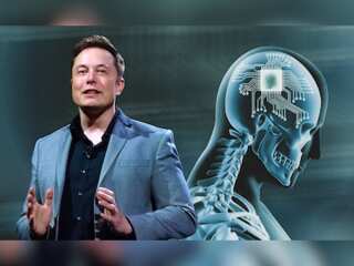 WION Fineprint | Excessive animal deaths at Musk's Neuralink?