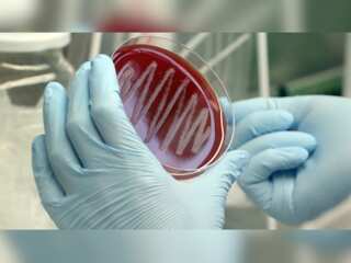 A new infection called Strep-A is spreading in the UK