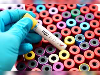 England on course to become first country to wipe out Hepatitis C in the World