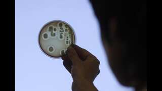 Scientists harness food by-products to fight antimicrobial resistance