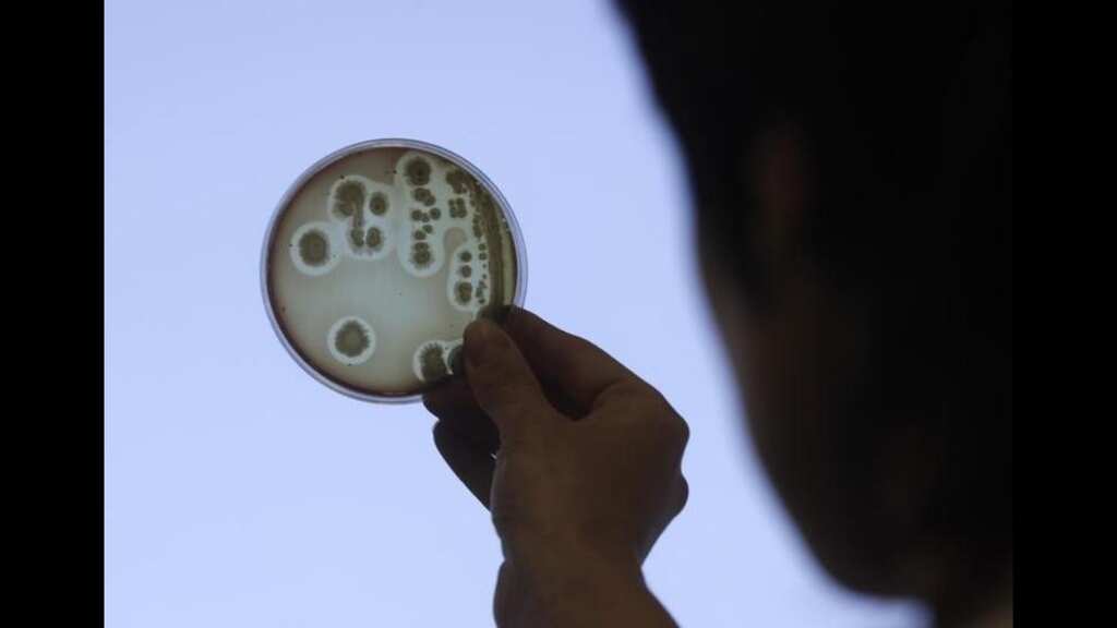 Scientists harness food by-products to fight antimicrobial resistance