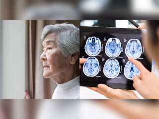 Scientists reveal how to detect signs of Dementia 9 years before diagnosis