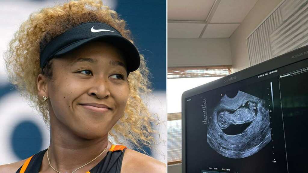 Naomi Osaka pregnant: who is her boyfriend Cordae? check Osaka age, net worth, father & all you need to know