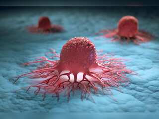 Potential breakthrough in preventing secondary cancers?