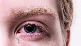 Rare eye condition caused by tiny beetle, troubles remote part of southeastern Australia