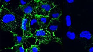 Genetically modified bacteria could treat lung infections, reveals study