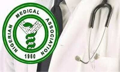 Brain drain: Nigeria lost 2,800 resident doctors in 2 years