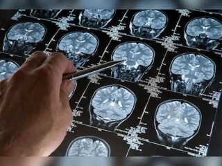 People with autism feel pain more, says study