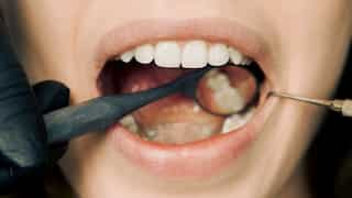 Celebrity dentist shares five tips for healthy gums