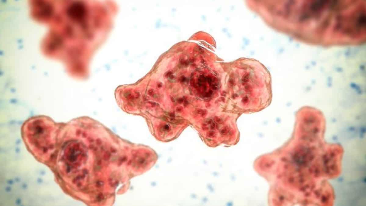 Florida resident dies after getting infected with rare brain-eating amoeba through tap water Florida resident dies after getting infected with rare brain-eating amoeba through tap water