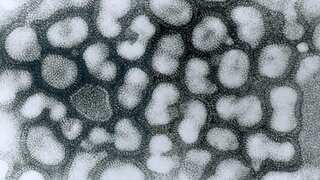What is H3N8 or bird flu? China reports first case of 2023, here's all you need to know