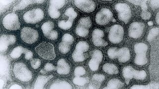 What is H3N8 or bird flu? China reports first case of 2023, here's all you need to know
