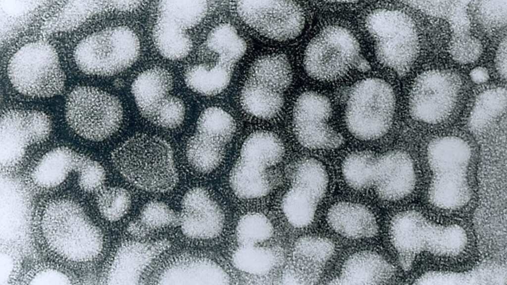 What is H3N8 or bird flu? China reports first case of 2023, here's all you need to know