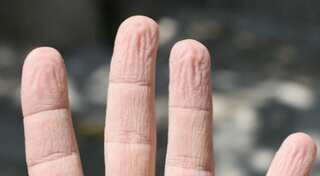 Wonder why fingers wrinkle under water? We finally have the answer to it
