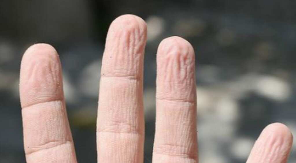 Wonder why fingers wrinkle under water? We finally have the answer to it