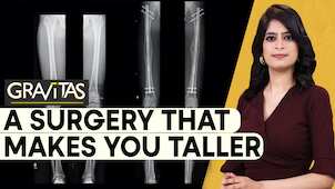 Gravitas: Would you go under the knife to increase your height?