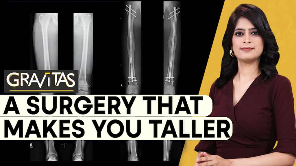 Gravitas: Would you go under the knife to increase your height?