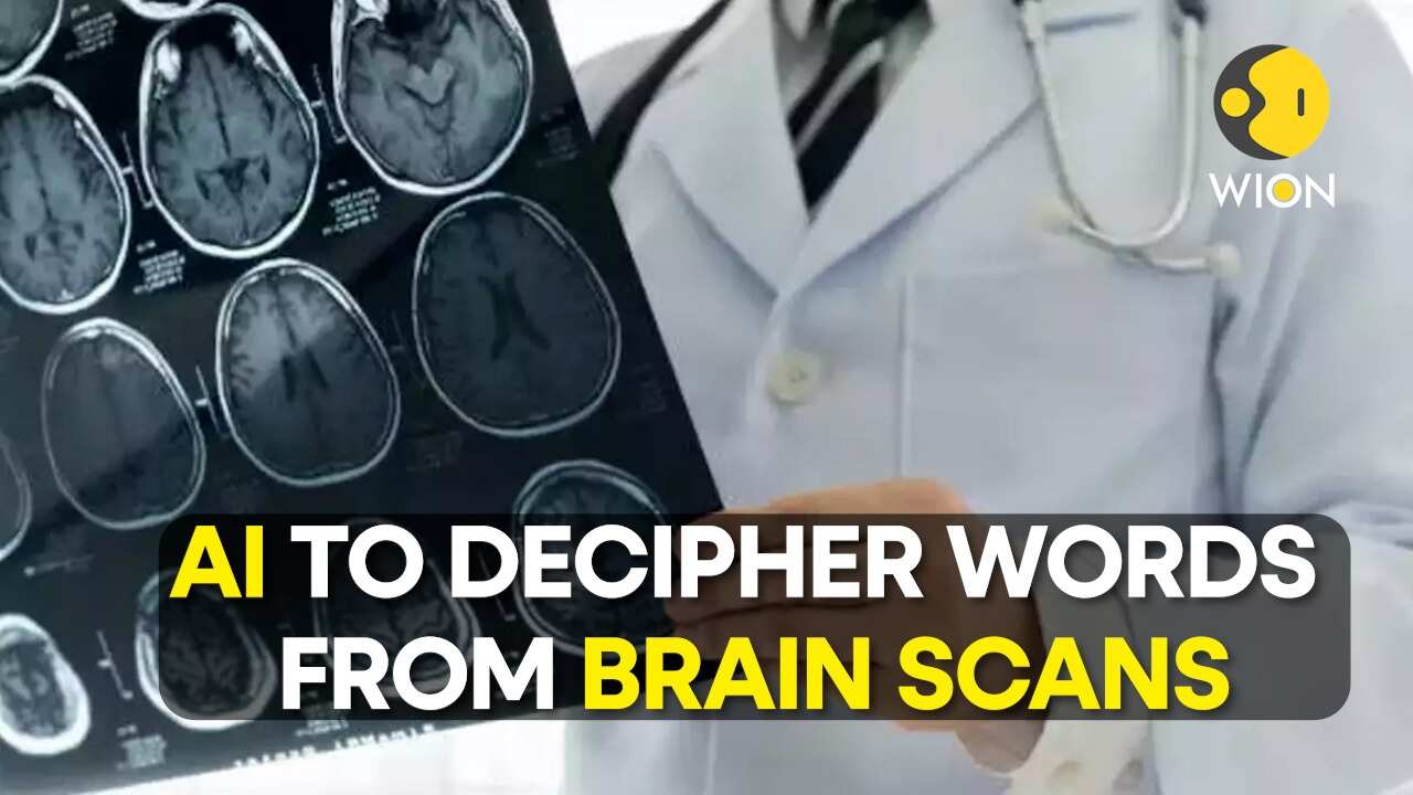 Scientists Can Now Use Ai To Convert Brain Scans Into Words Edge News Scientists Can Now Use Ai To Convert Brain Scans Into Words Edge News