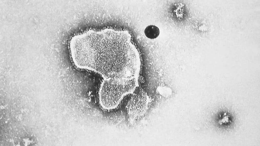 Breakthrough! US approves world's first RSV vaccine: All you need to know