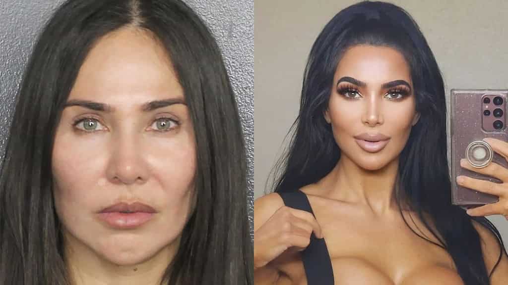 Kim Kardashian's lookalike death: 'Unlicensed' Florida practitioner charged with involuntary manslaughter