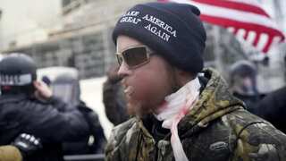 USA: Capitol Hill rioter Joshua Black, who was shot in face, sentenced to two years in prison