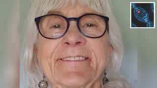 Meet this Scottish 'Superman-esque' grandmother who feels no pain, fear and anxiety