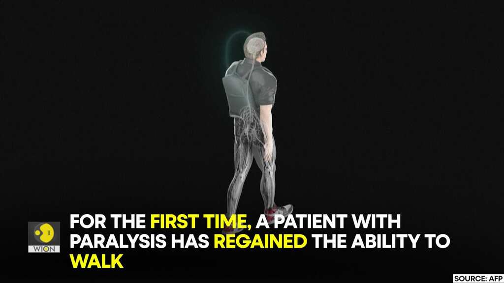 Electronic brain implants help paralysed man to walk again