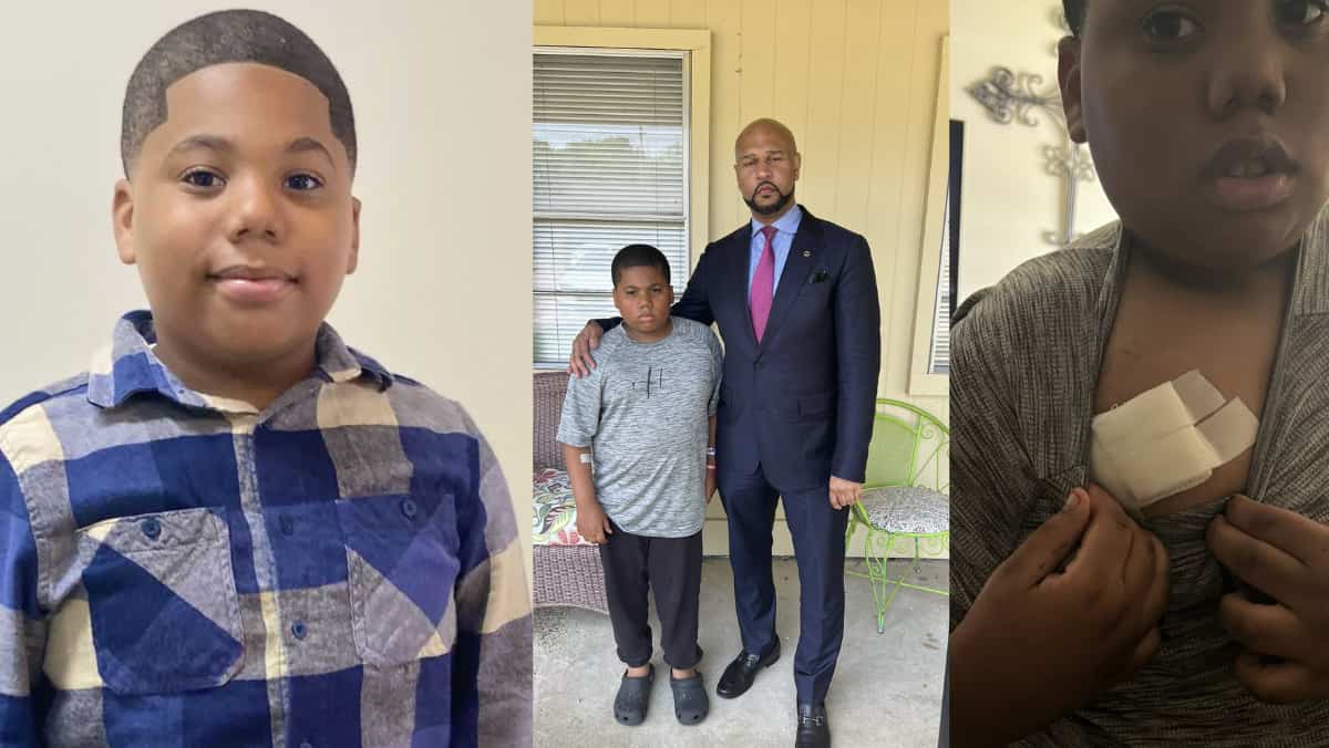 11-year-old Black boy shot in chest by Mississippi police he called for help 11-year-old Black boy shot in chest by Mississippi police he called for help