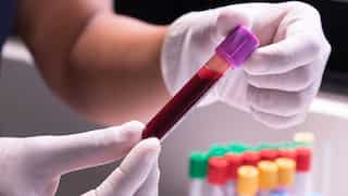 Medical breakthrough! Multi-cancer blood test shows real potential in NHS study