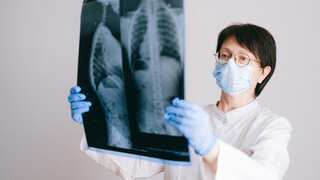Researchers find 'pill' that can cut risk of death from lung cancer by half