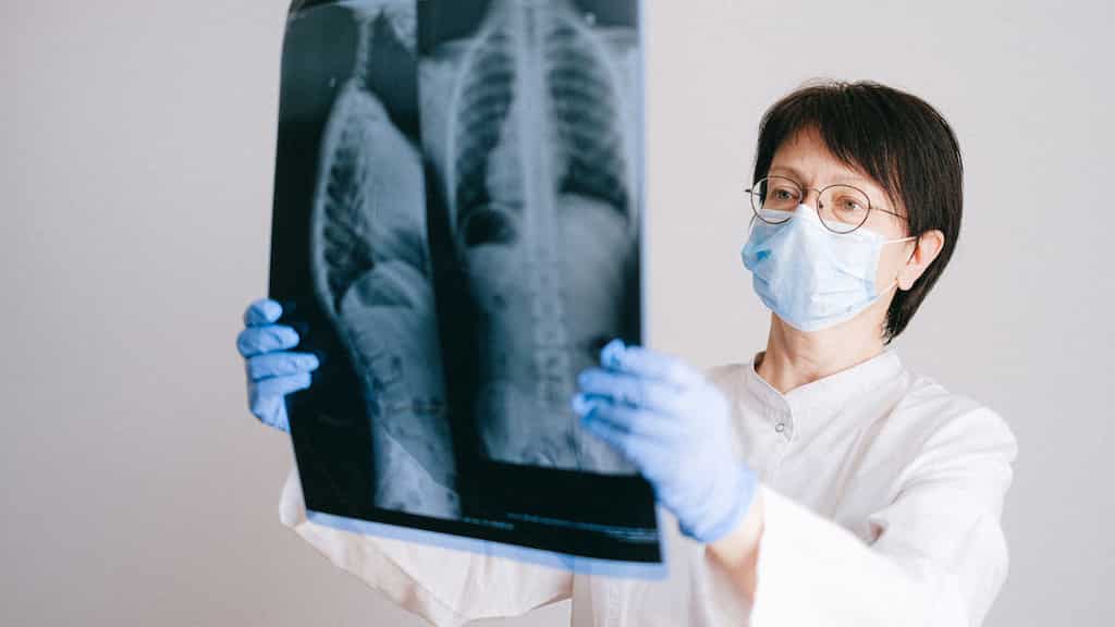 Researchers find 'pill' that can cut risk of death from lung cancer by half