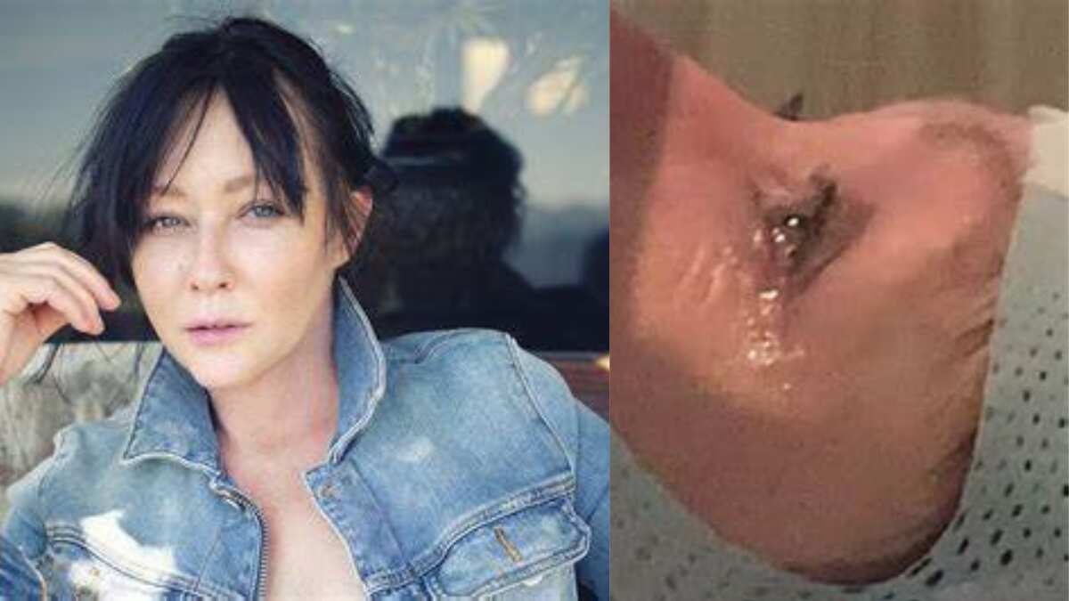Shannen Doherty's stage 4 breast cancer has spread to her brain, shares a video from her treatment Shannen Doherty's stage 4 breast cancer has spread to her brain, shares a video from her treatment
