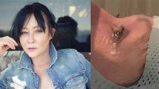 Shannen Doherty's stage 4 breast cancer has spread to her brain, shares a video from her treatment