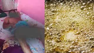 India: Wife throws boiling oil on husband’s genitals after heated argument