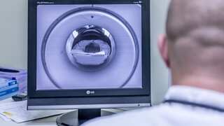 Nasal drops show remarkable promise in stroke recovery, study finds