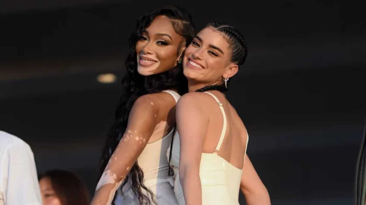Winnie Harlow and Dixie D'Amelio